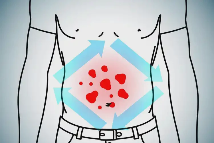 大學(xué)生肚子容易長濕疹不管它會自己痊愈嗎(圖4)