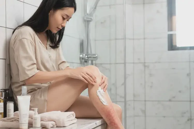 女生小腿上偶爾起濕疹不管它會自己痊愈嗎(圖1)