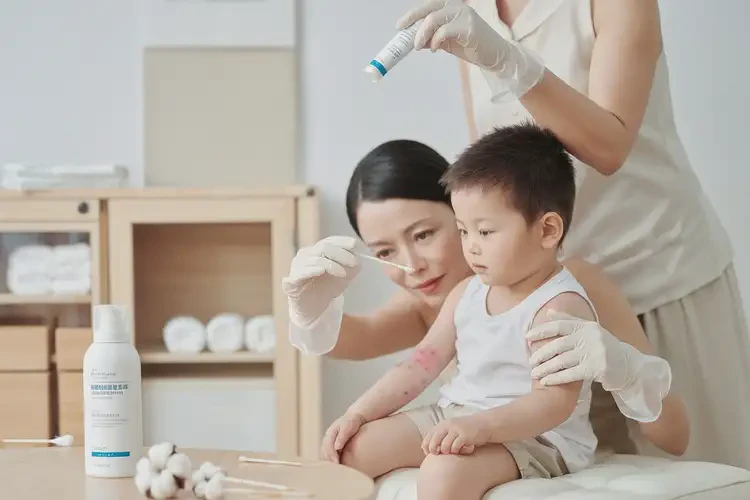 小孩臉上有濕疹可以徹底自愈嗎(圖3)