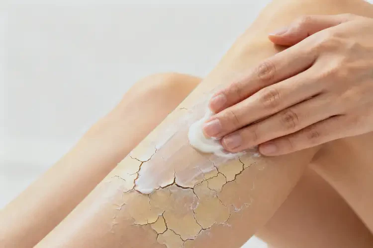 女性全身出湿疹能彻底自愈吗(图1)