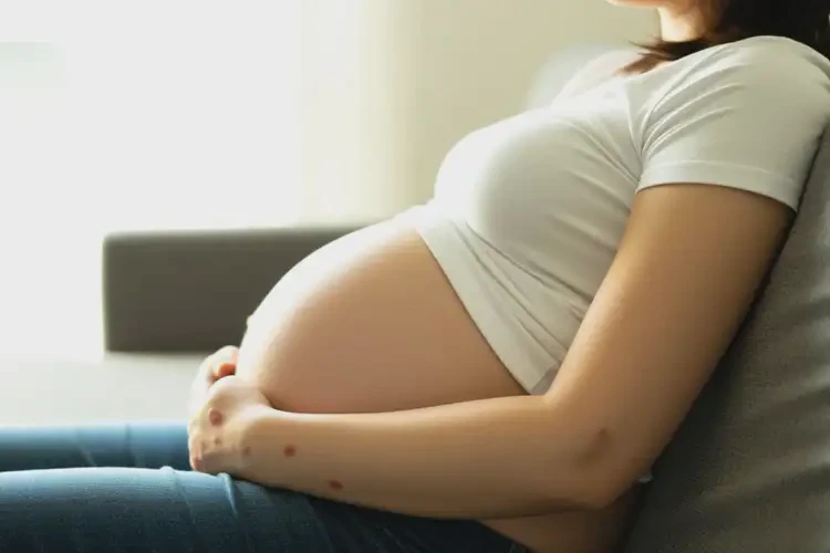 孕婦身上出濕疹可不可以徹底自愈(圖3)