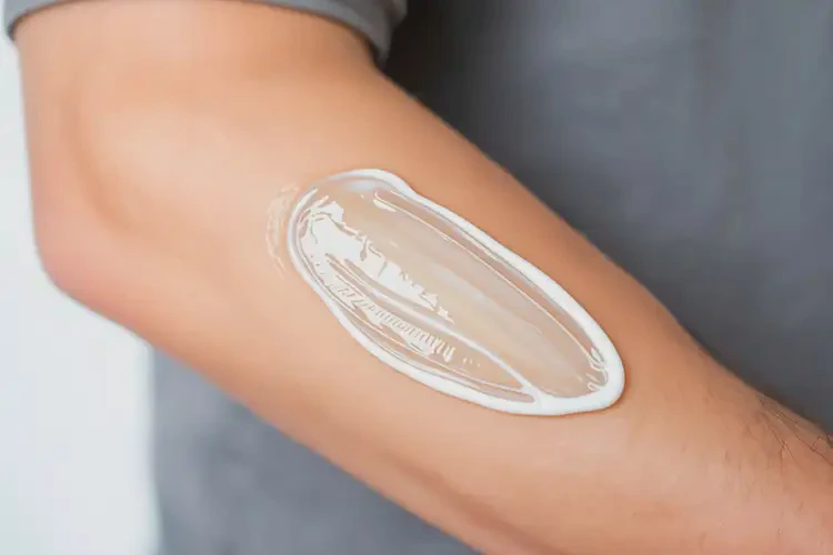 青年人手臂出濕疹可不可以徹底自愈(圖2)