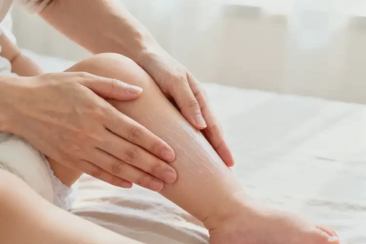 嬰兒小腿上容易起濕疹能夠徹底治愈嗎(圖2)