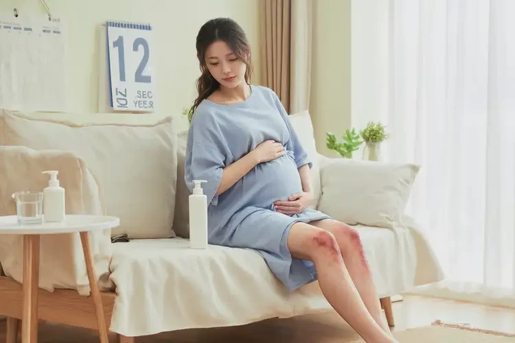 孕婦大腿有濕疹不管它會自己自愈嗎(圖3)