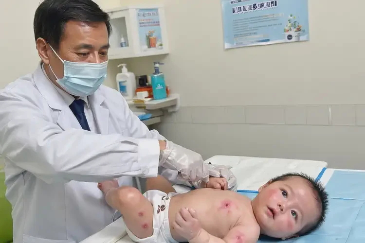 寶寶脖子起濕疹不管它會自己自愈嗎(圖2)