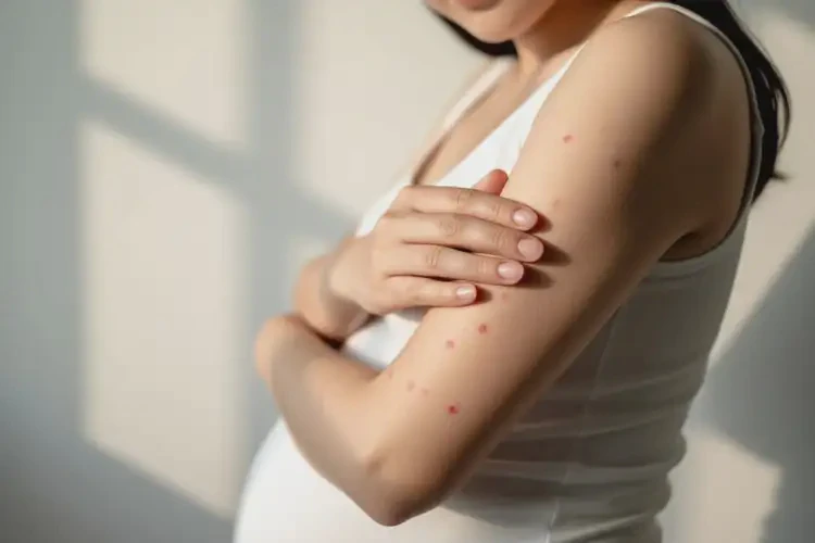 孕妇手臂容易长湿疹不管它会自己痊愈吗(图3)