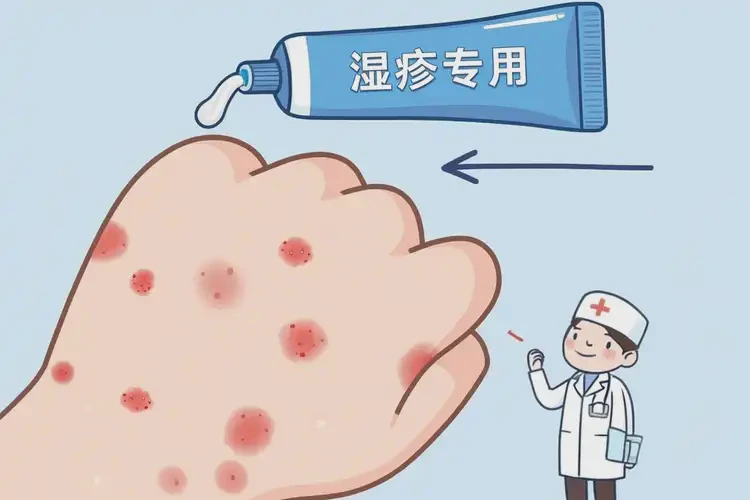 小兒手上經常長濕疹能靠自己自愈嗎(圖3)