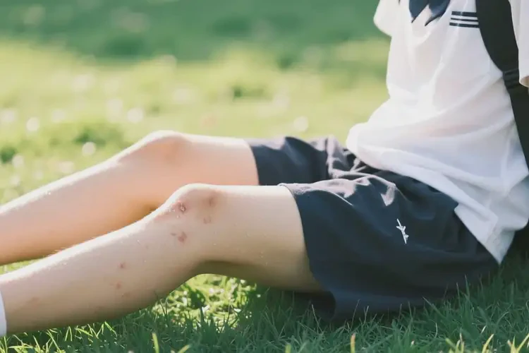 大學(xué)生大腿偶爾起濕疹能夠徹底治愈嗎(圖3)