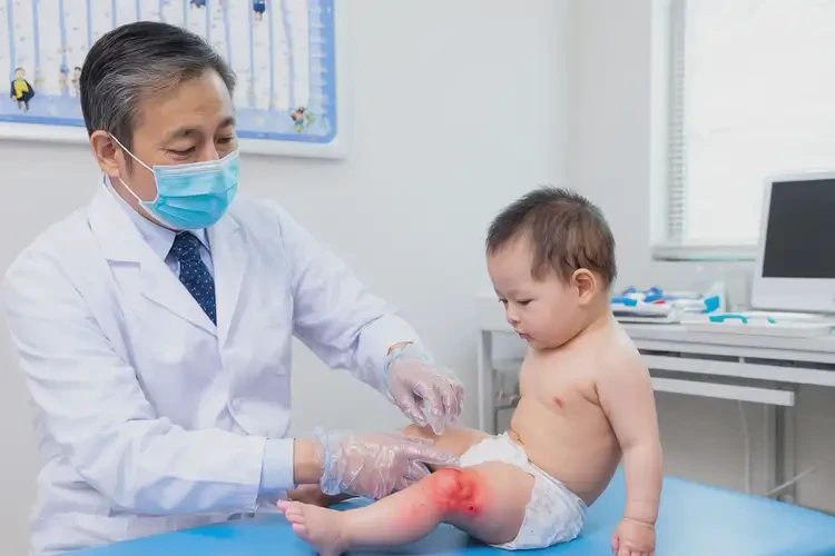 嬰幼兒大腿有濕疹可以徹底自愈嗎(圖1)