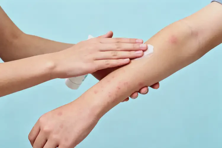 青少年手臂上長(zhǎng)濕疹能夠徹底治愈嗎(圖1)