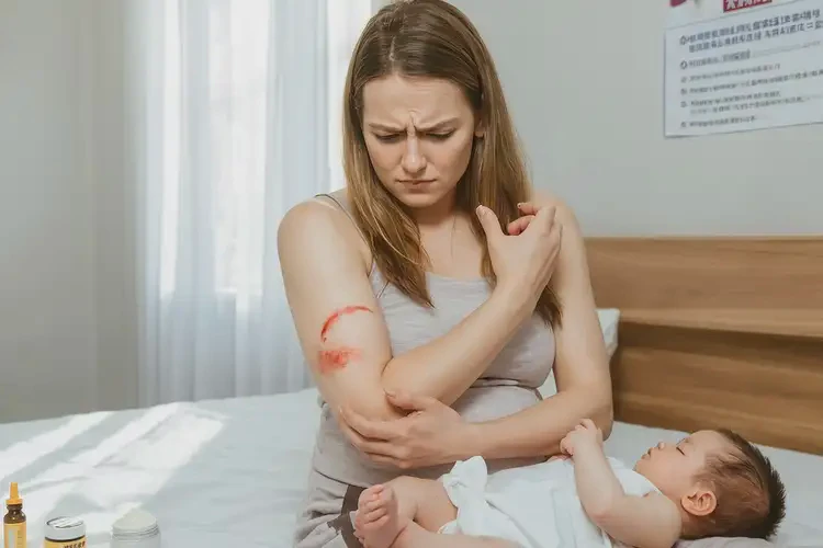 哺乳期媽媽屁股上出現(xiàn)濕疹不管它會自己自愈嗎(圖4)