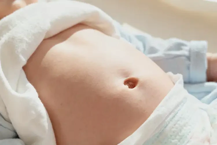 新生兒肚子出濕疹可不可以徹底自愈(圖3)