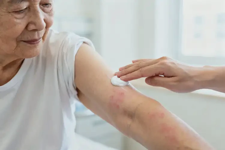 高齡老人手臂偶爾長濕疹不管它會(huì)自己好嗎(圖4)