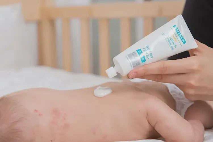 小兒屁股經(jīng)常起濕疹能徹底自愈嗎(圖2)