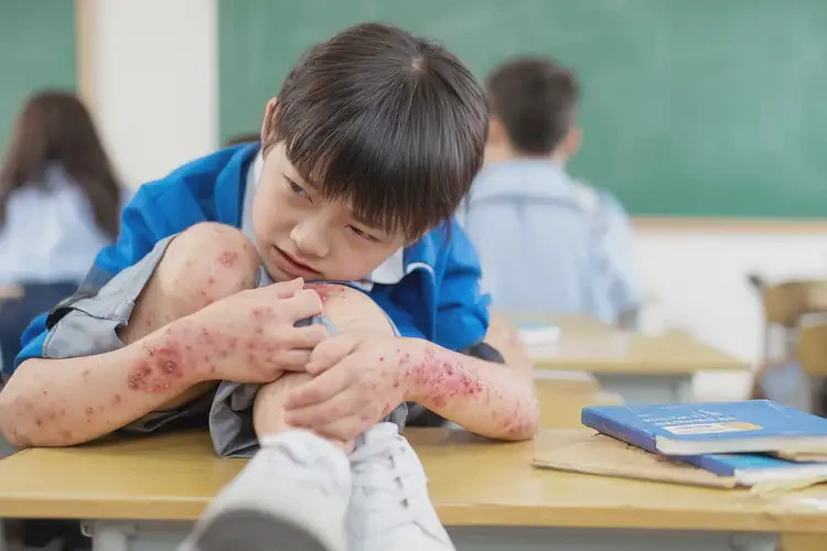小學(xué)生小腿偶爾起濕疹能夠徹底治愈嗎(圖4)