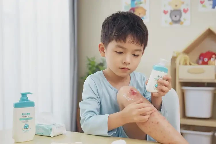 兒童小腿經(jīng)常起濕疹能靠自己自愈嗎(圖3)
