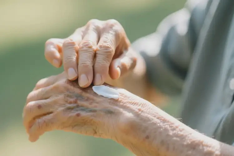 高齡老人手臂上有濕疹不管它會自己好嗎(圖3)