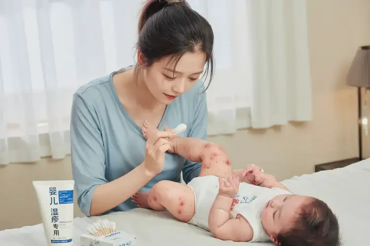 嬰兒小腿經(jīng)常起濕疹能靠自己自愈嗎(圖3)