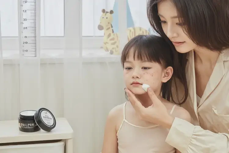 兒童臉上出濕疹能徹底自愈嗎(圖3)