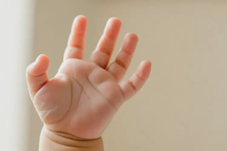 嬰兒手上經(jīng)常長(zhǎng)濕疹能徹底自愈嗎(圖4)