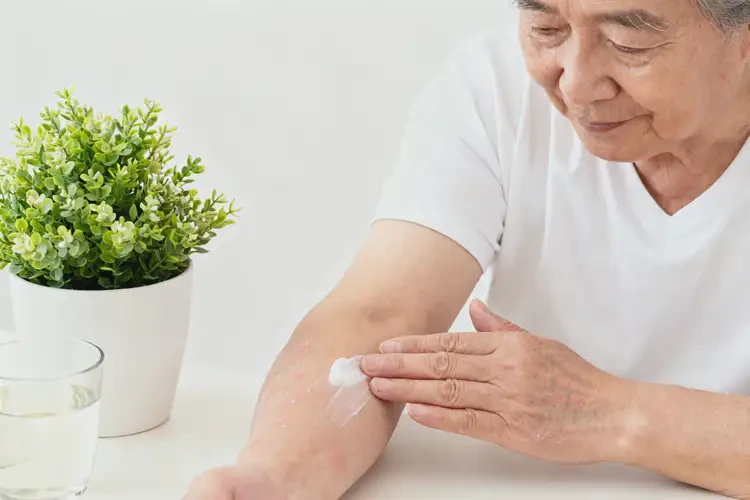 老年人手臂上經(jīng)常起濕疹能夠徹底治愈嗎(圖4)