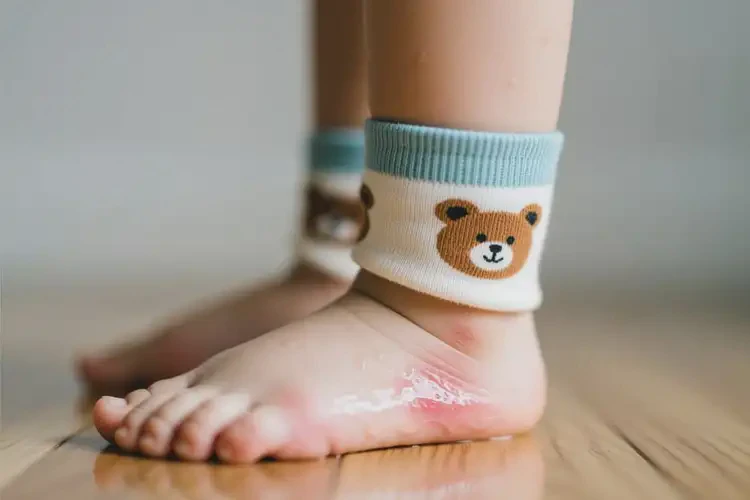 小孩腳上長濕疹能靠自己自愈嗎(圖2)