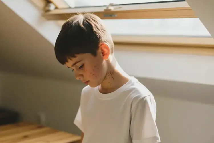 男生脖子偶爾長濕疹可不可以徹底自愈(圖2)