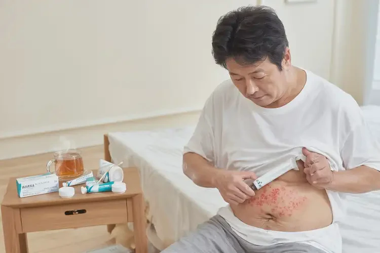 男性肚子偶爾起濕疹能夠徹底治愈嗎(圖3)