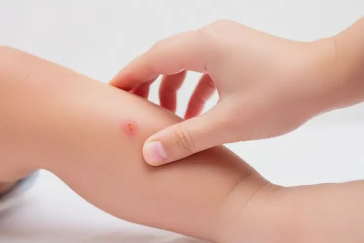 幼兒小腿上出濕疹能徹底自愈嗎(圖1)