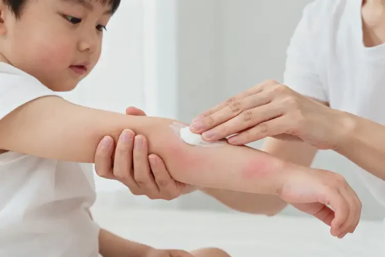 小儿手臂上出湿疹不管它会自己自愈吗(图4)