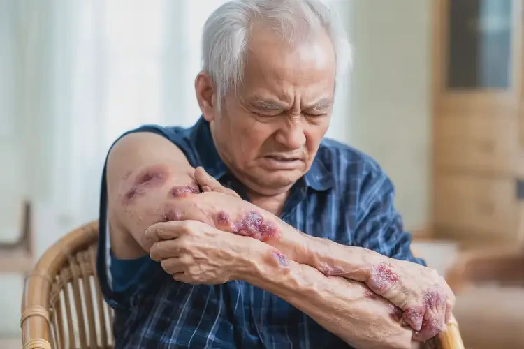 老人身上起濕疹不管它會自己痊愈嗎(圖4)