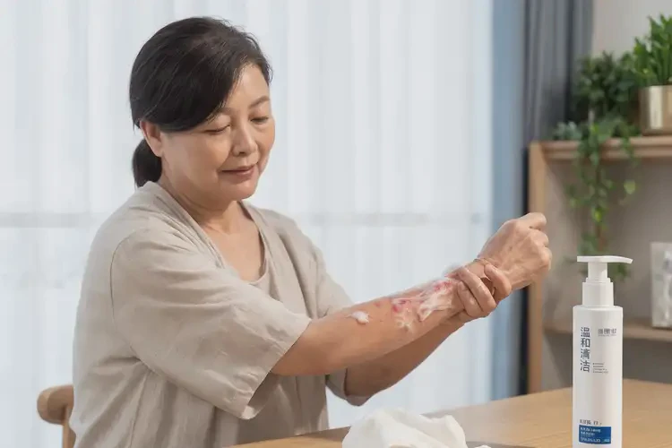 產(chǎn)婦手臂上經(jīng)常起濕疹不管它會(huì)自己好嗎(圖3)