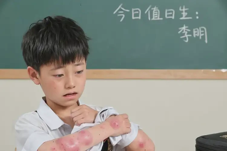 小學(xué)生手臂上出濕疹能徹底自愈嗎(圖4)