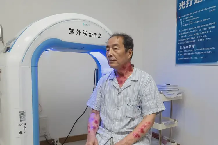 男性身上出濕疹不管它會自己自愈嗎(圖1)