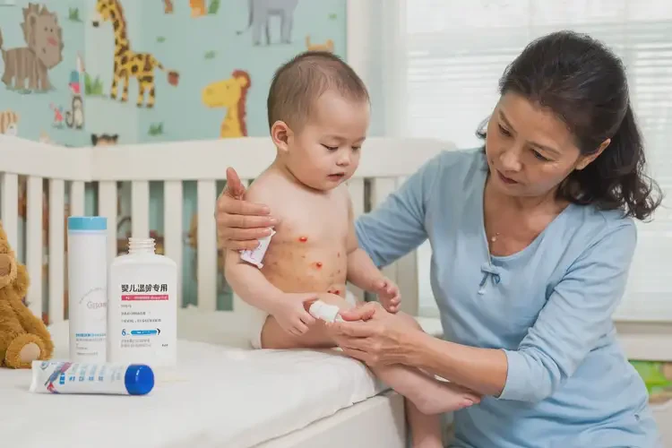 小孩屁股上出現(xiàn)濕疹不管它會(huì)自己好嗎(圖2)