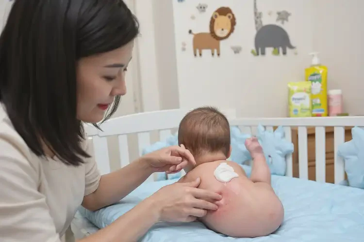 寶寶全身偶爾起濕疹不管它會(huì)自己痊愈嗎(圖3)