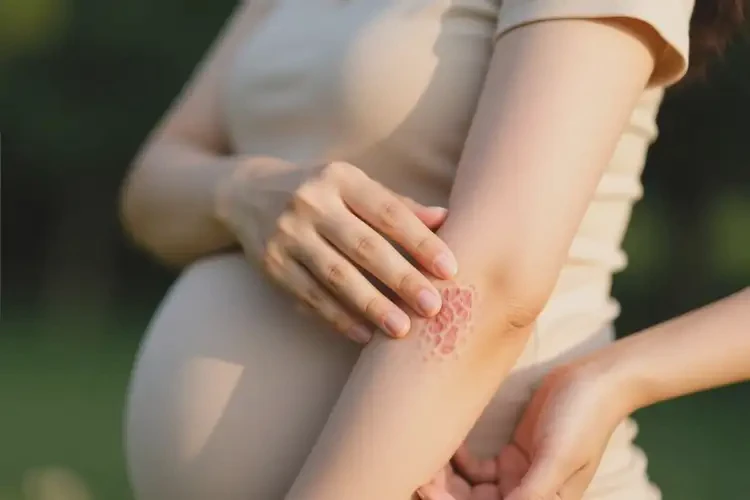 孕婦手臂經(jīng)常長(zhǎng)濕疹不管它會(huì)自己自愈嗎(圖3)