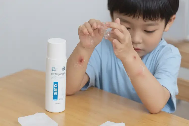 兒童手上經(jīng)常起濕疹能夠徹底治愈嗎(圖2)