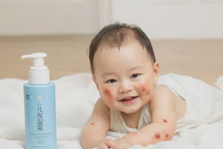 嬰幼兒身上容易長濕疹不管它會自己好嗎(圖4)