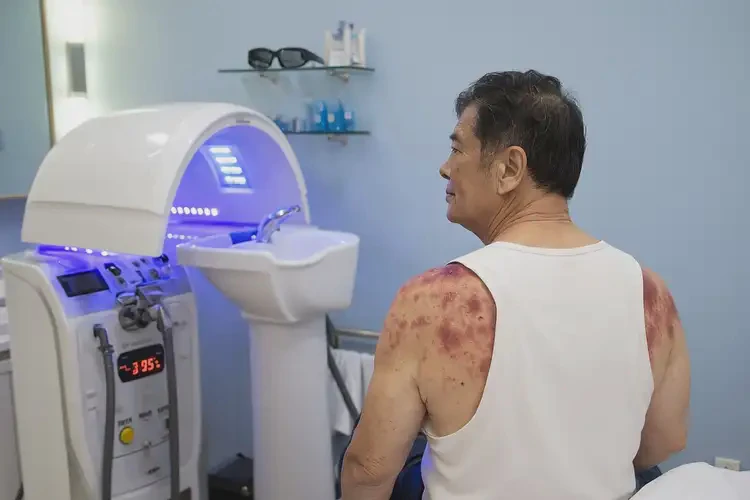 男人身上容易長濕疹不管它會自己自愈嗎(圖2)