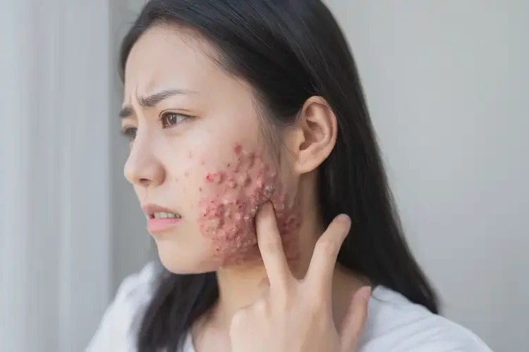 女人脖子上出現(xiàn)濕疹不管它會自己痊愈嗎(圖4)