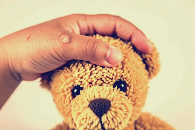 小學(xué)生手上容易起濕疹不管它會(huì)自己好嗎(圖1)