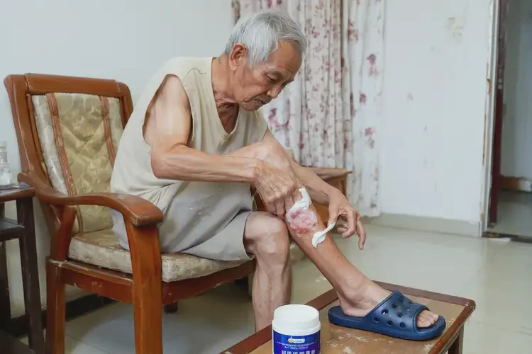 老人小腿偶爾長濕疹可以徹底自愈嗎(圖3)