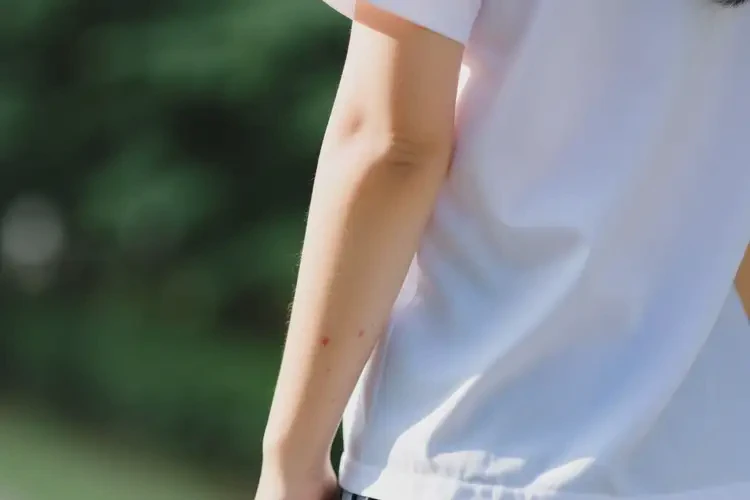 中学生手臂经常起湿疹不管它会自己痊愈吗(图2)