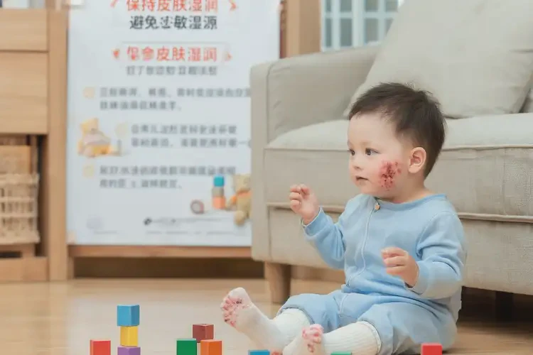 幼儿脚上有湿疹能彻底自愈吗(图1)