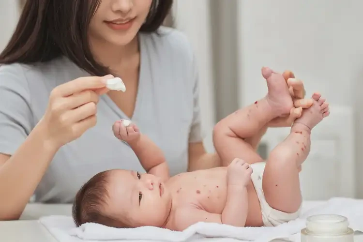 新生儿小腿出湿疹能彻底自愈吗(图3)