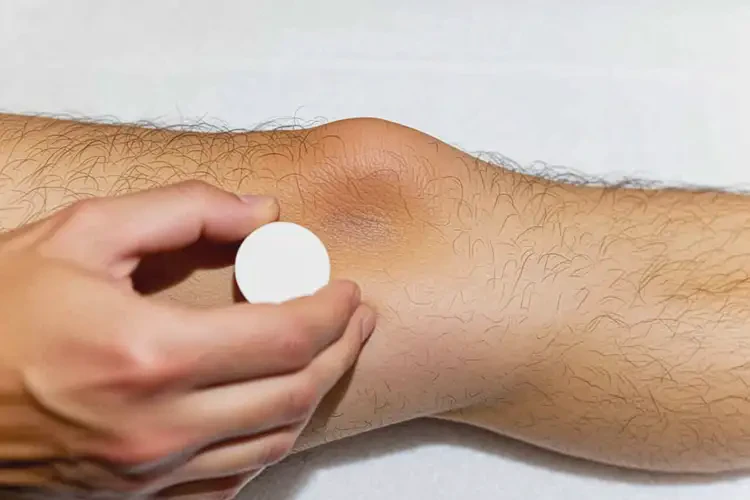 男性大腿偶爾起濕疹能夠徹底治愈嗎(圖2)