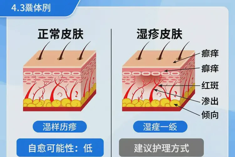 高齡老人大腿容易長濕疹能徹底自愈嗎(圖2)