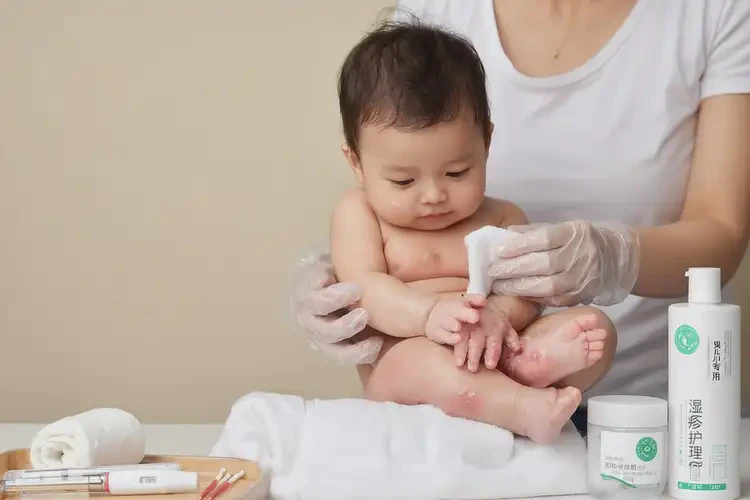 嬰兒手上出濕疹不管它會(huì)自己痊愈嗎(圖2)