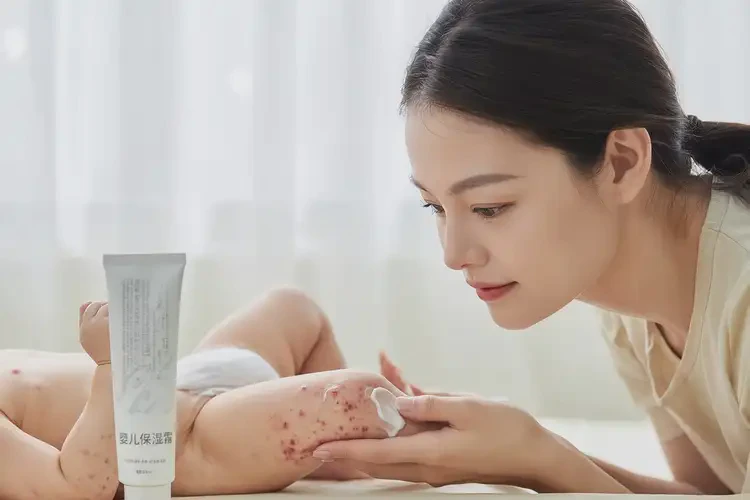 寶寶大腿上長濕疹不管它會自己好嗎(圖3)